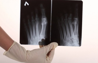 Fußschmerzen? Einige Ratschläge, um diese zu lindern