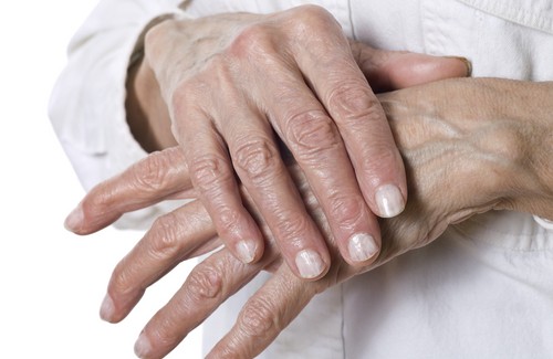 Natürliche Heilmittel für Schrunden an den Händen