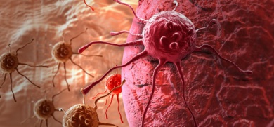 Krebs: Typische Symptome bei Frauen
