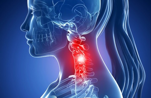 Nackenschmerzen: Ursachen und Behandlung
