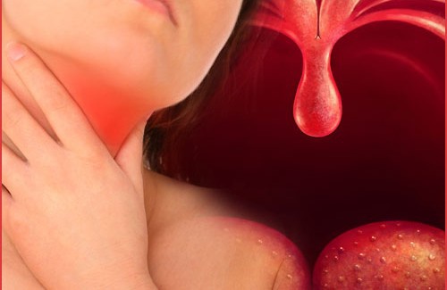 Was hilft bei Rachenentzündungen? Ernährung und Naturheilmittel