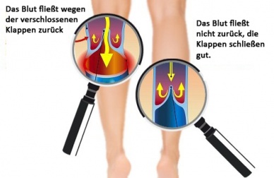 Wie du für eine bessere Durchblutung in Händen und Füßen sorgen kannst