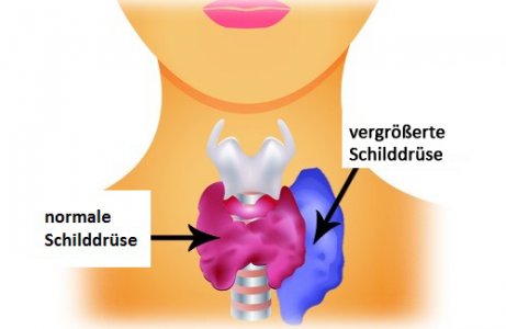 Nahrungsmittel zur Regelung der Schilddrüsenfunktion