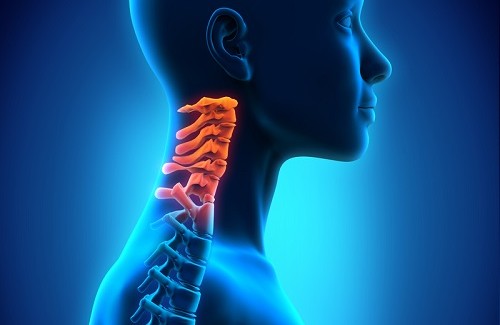 Nackenschmerzen und Schwindel: Gründe und Heilmittel