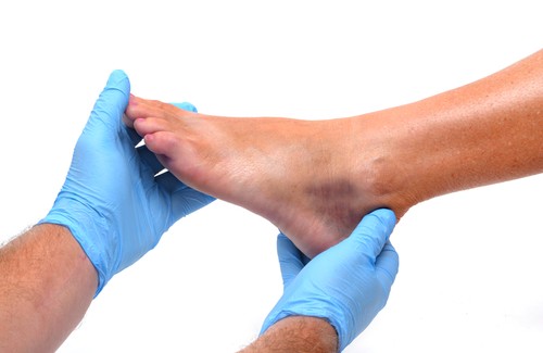 Ursachen für geschwollene Füße und Knöchel