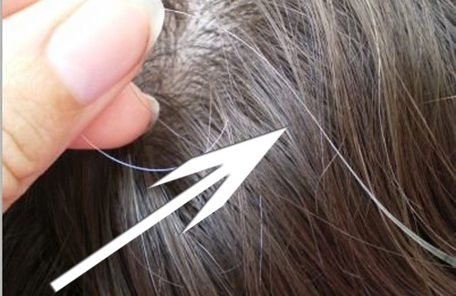 Vorzeitige graue Haare – Was könnten die Ursachen sein?