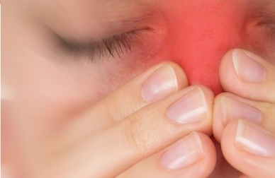 5 natürliche Hausmittel die bei Sinusitis Symptomen helfen könnten