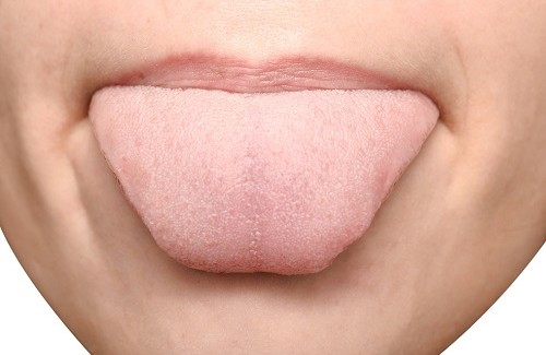 Welche Krankheiten kann unsere Zunge verraten?