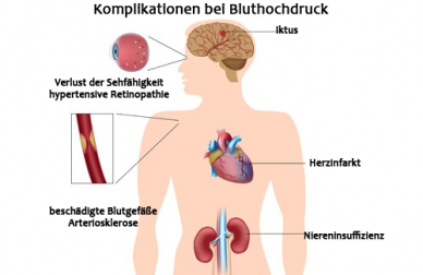Die besten Nahrungsmittel gegen Bluthochdruck