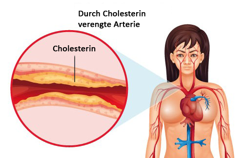Cholesterin