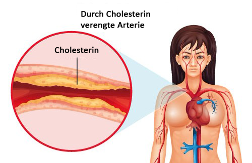 Knoblauch und Hafer gegen Cholesterin