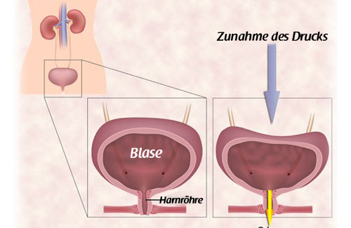 Harninkontinenz – Übungen für Frauen Harninkontinenz – Übungen für Frauen