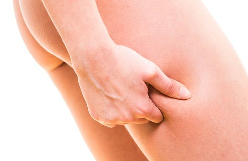 Einfache Übungen gegen Cellulite Einfache Übungen gegen Cellulite