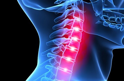 Bessere Haltung – weniger Nackenschmerzen Bessere Haltung – weniger Nackenschmerzen