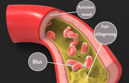 arterie