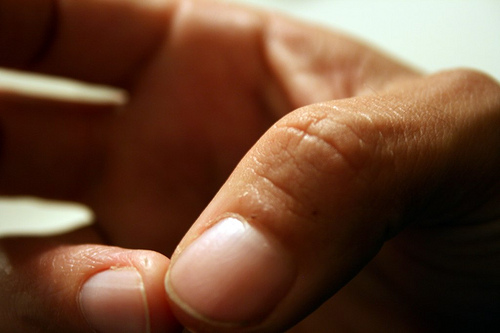 Ekzeme-Finger