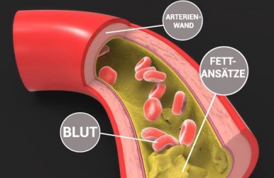 Cholesterinspiegel senken - natürliche Methoden