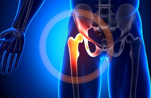 Kalziummangel - Was kann ich tun?