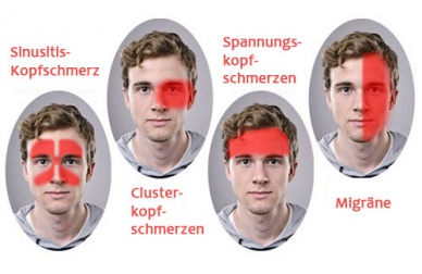 Neue Therapie gegen Migräne