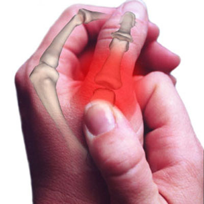Gründe für Schmerzen in den Händen und Handgelenken