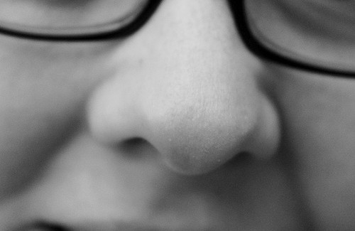 Was tun gegen Mitesser?