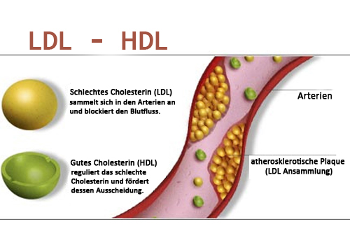 cholesterin1