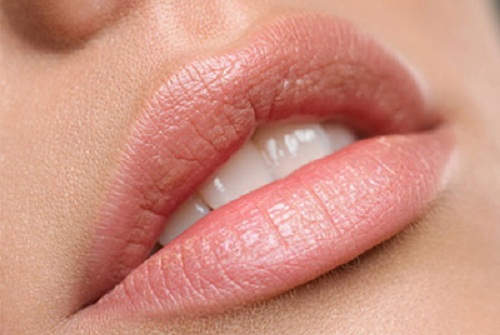 Die besten natürlichen Mittel gegen trockene Lippen