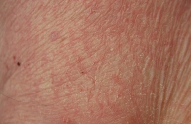 Was verrät deine Haut über deinen Gesundheitszustand?