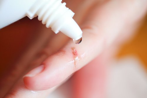 schlechte Wundheilung ist eines der Symptome eines schwachen Immunsystems