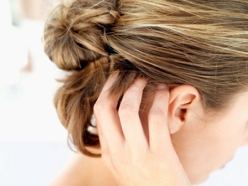 5 Tipps gegen Kopfläuse