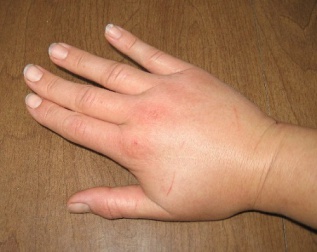 Tees die gegen Wassereinlagerungen helfen können