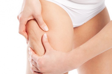 Tees gegen Durchblutungsstörungen, die bei Cellulite helfen könnten