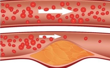 Heilkräuter für die Cholesterinregulierung