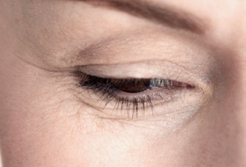 Falten unter den Augen natürlich behandeln Falten unter den Augen natürlich behandeln