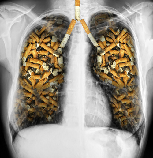 Lungen-Zigaretten
