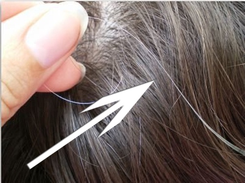 Sind einzelne graue Haare normal?