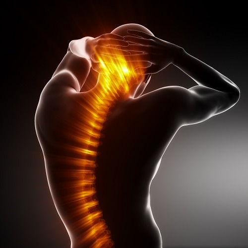 ischiasbehandlung