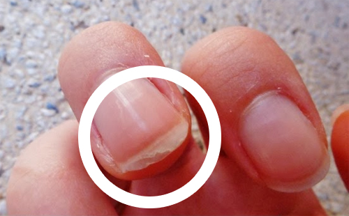 Fingernaegel