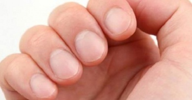 Was Nägel alles über die Gesundheit verraten