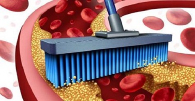 10 Nahrungsmittel zur Reinigung der Arterien