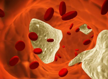 8 Tipps, Cholesterinwerte natürlich zu senken