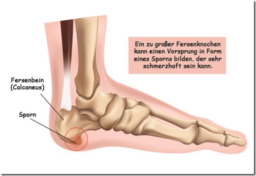 Fersensporn
