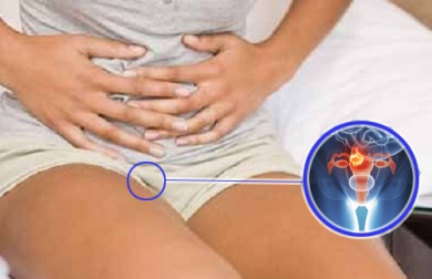 Gebärmutterhalskrebs erkennen: 7 Symptome