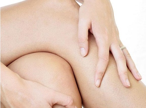 knie