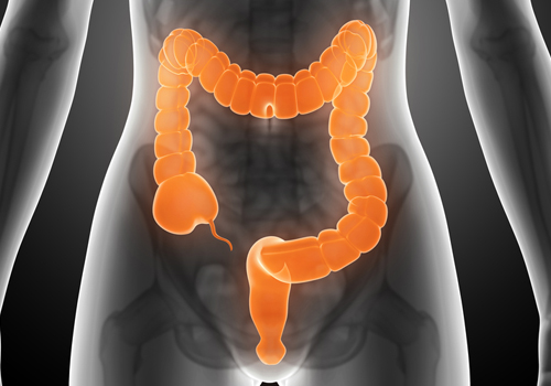Schmerzhafter Reizdarm