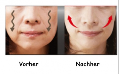 4 Tipps für straffe Wangen