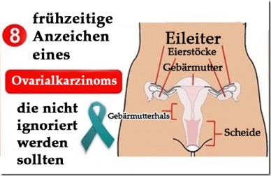 8 frühzeitige Anzeichen eines Ovarialkarzinoms