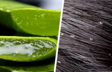 Was gegen Schuppen einfach und effektiv helfen könnte