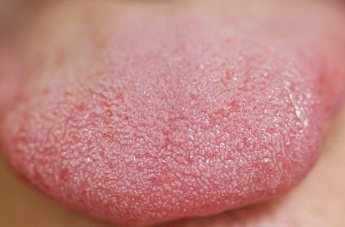 Was eine rosafarbene Zunge über Seele und Gesundheit verrät