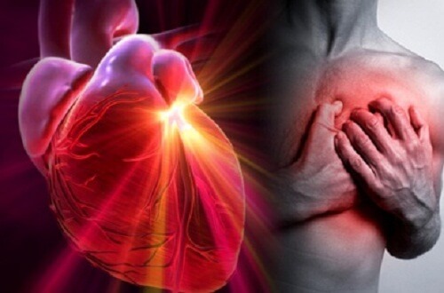 Herzinfarkt, Herzstillstand, Schlaganfall: Wie erkennt man den Unterschied?